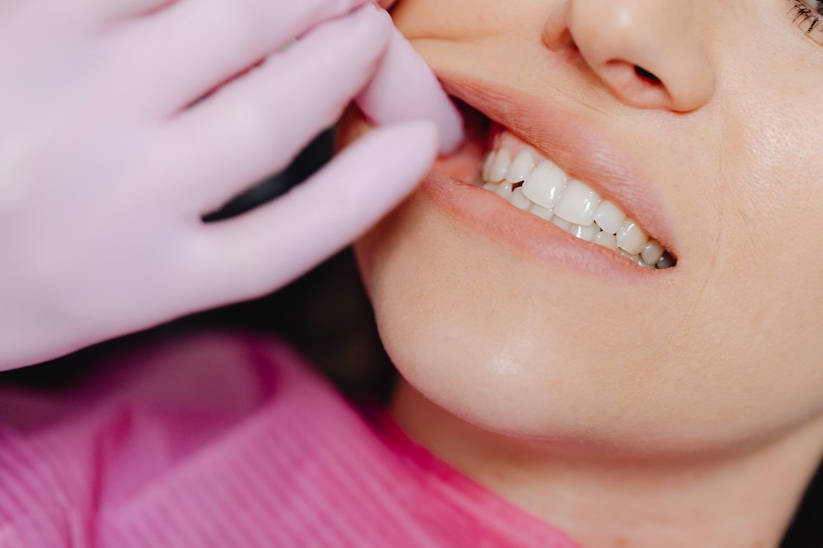 dentista revisando la boca a una paciente